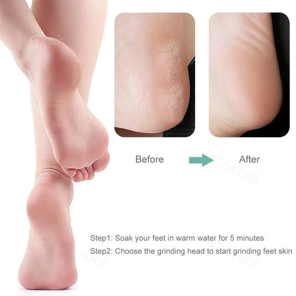 Electric Foot File
